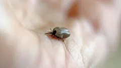 Eine Zecke auf der Haut: Was ist zu tun und an wen kann man sich nach einem Biss wenden?